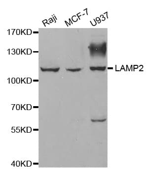 Polyclonal Rabbit anti-Human LAMP2 / CD107b Antibody (IHC, WB)
