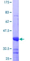 Human NR4A2 / NURR1 Protein (Recombinant GST, N-terminus)
