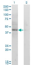 Monoclonal Mouse anti-Human ACAT2 Antibody (clone 4A5, WB)