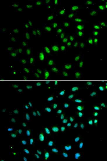 CD27 Antibody