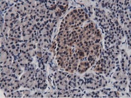 BTN1A1 Antibody (clone OTI7B5)