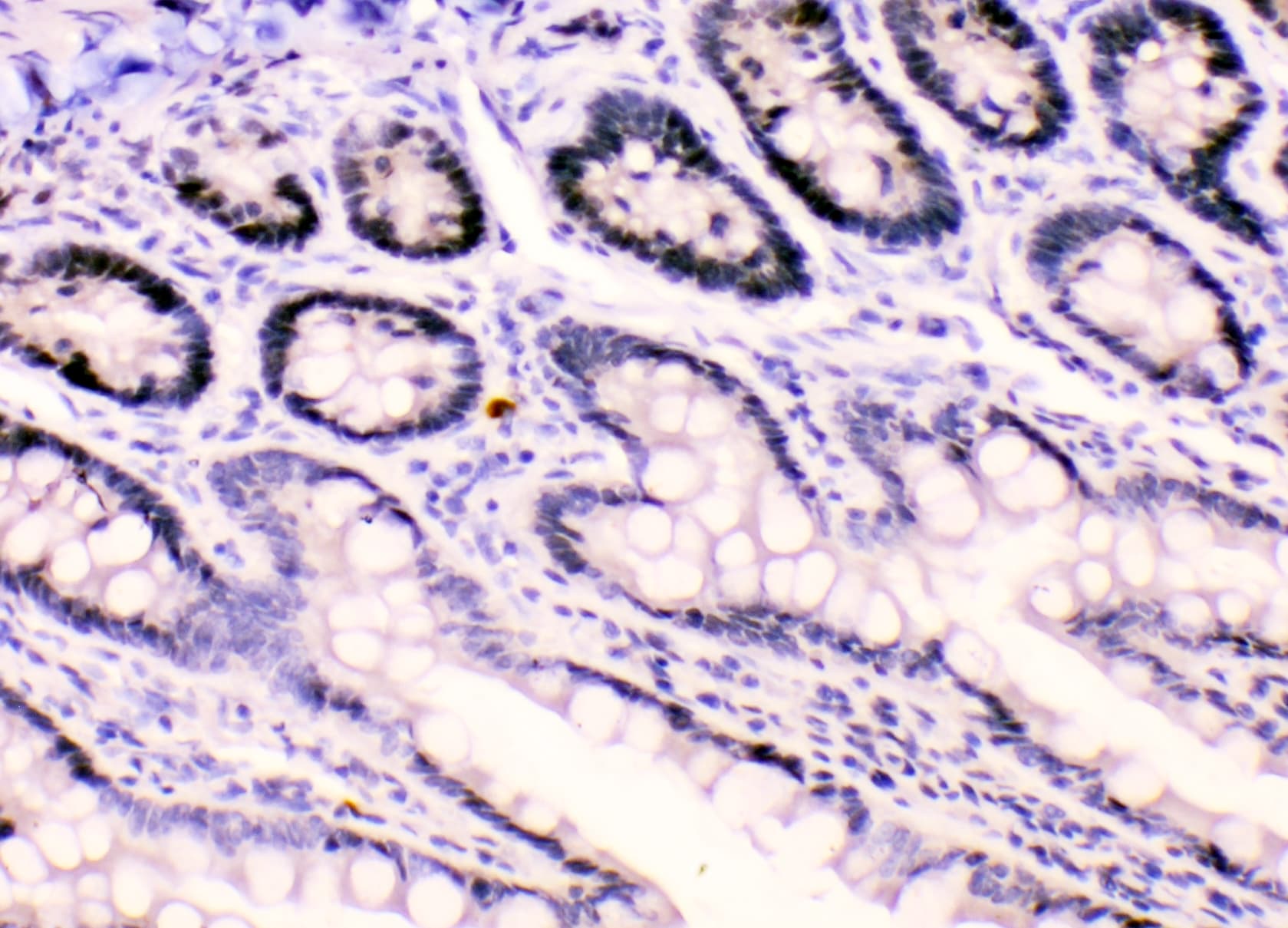 HNRNPF / hnRNP F Antibody