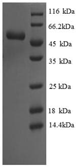 Saccharomyces cerevisiae CYS3 Protein (Recombinant 6His, N-terminus)