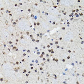 SMAD5 Antibody
