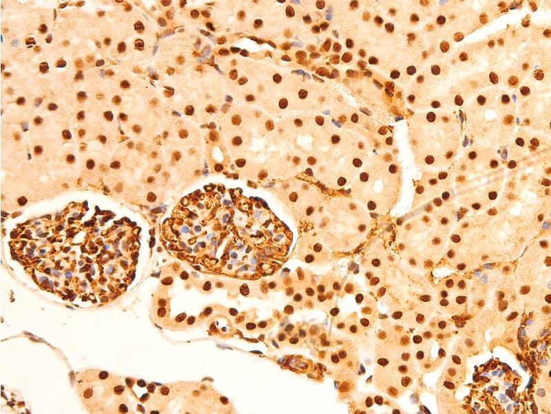 JUN / c-Jun Antibody (phospho-Ser243)