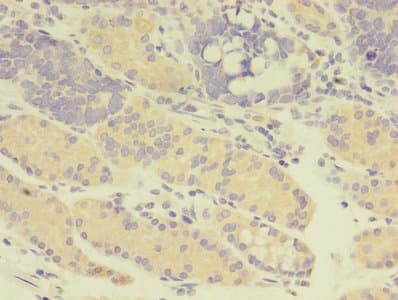 GDI2 Antibody (aa1-445)