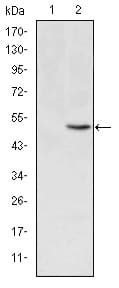 MTHFR Antibody (clone 5D3)