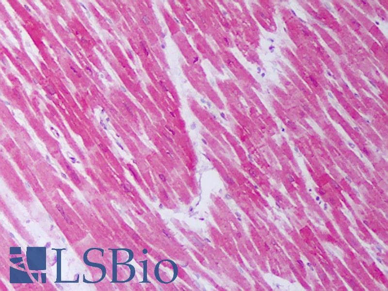 IHC-plus™ HSPB2 / HSP27 Antibody