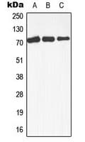 MAP3K3 / MEKK3 Antibody (Internal)