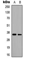 CD34 Antibody (Internal)
