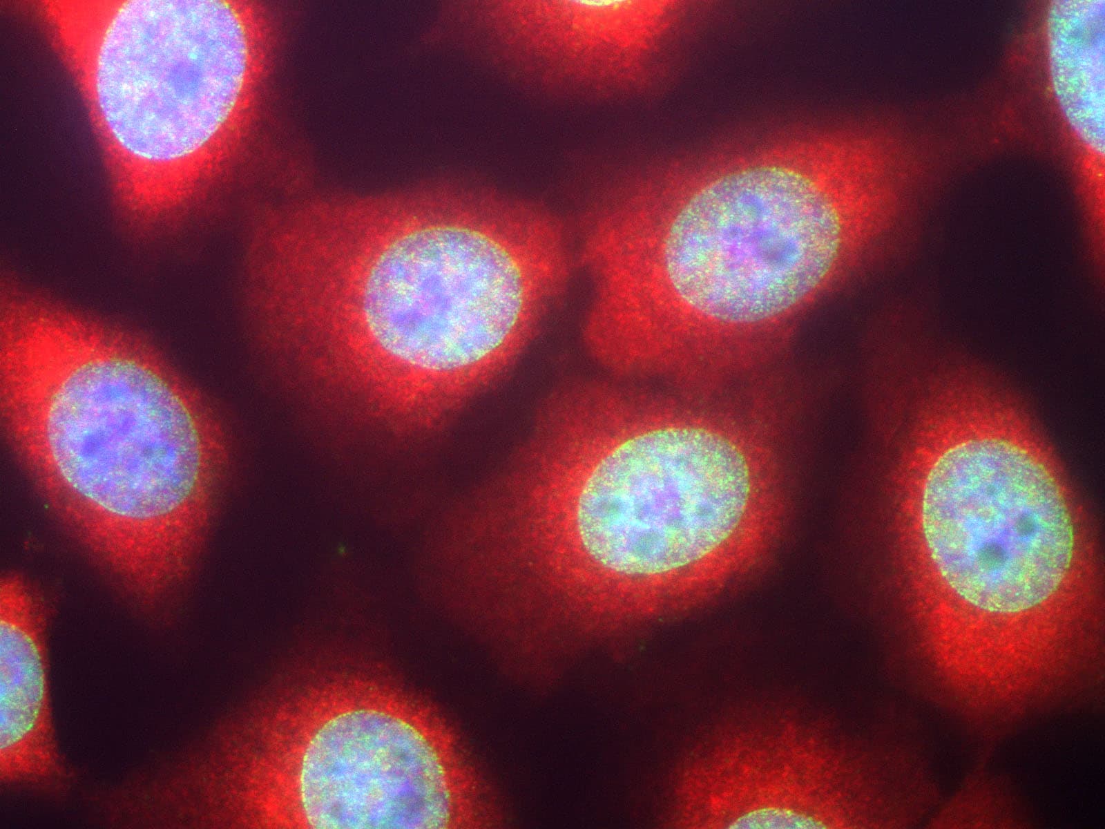 IHC-plus™ CSNK1A1 / CK1 Alpha Antibody
