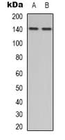 Polyclonal Rabbit anti-Human NOS3 / eNOS Antibody (C-Terminus, IHC, IF, WB)
