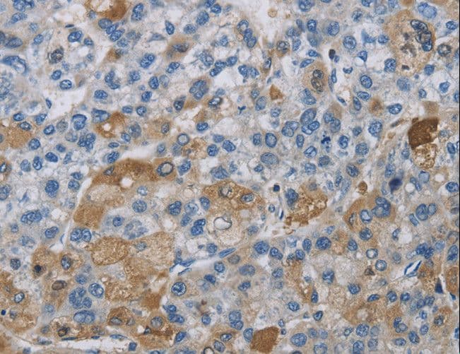 DNAJB4 Antibody