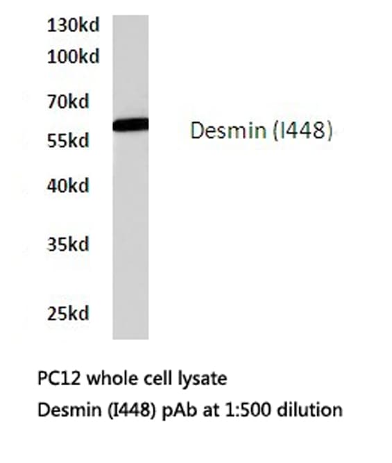IHC-plus™ DES / Desmin Antibody (Ile448)