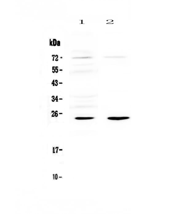 IL6 / Interleukin 6 Antibody