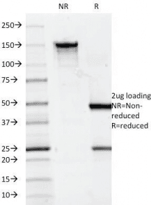 Monoclonal Mouse anti-Human CD7 Antibody (clone 124-1D1, IF)