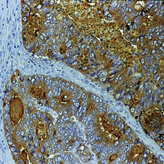 CEA / Carcinoembryonic Antigen Antibody (clone Col-1)