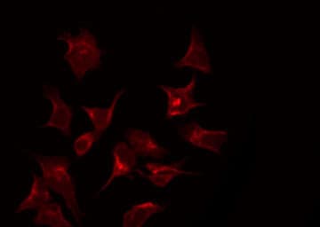 Polyclonal Rabbit anti-Human PRKCB / PKC-Beta Antibody (phospho-Ser661, IF, WB)