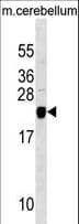 Polyclonal Rabbit anti-Human TAGLN3 / Neuronal Protein 22 Antibody (aa2-29, WB)