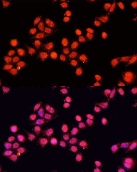 SLC24A5 / NCKX5 Antibody
