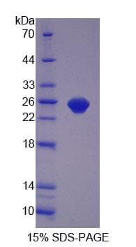 Human BDNF Protein (Recombinant His, N-Terminal)
