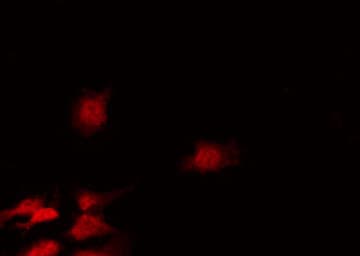 CDC25A Antibody (phospho-Ser75)
