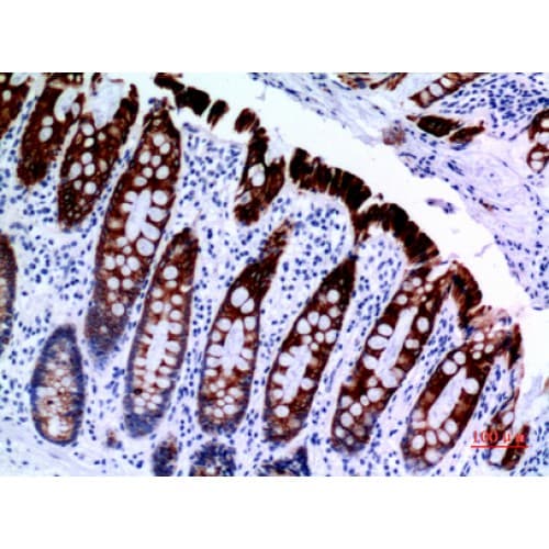 Polyclonal Rabbit anti-Human KRT8 / CK8 / Cytokeratin 8 Antibody (IHC, WB)
