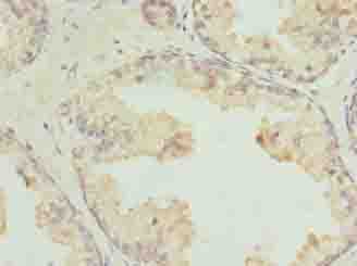 Polyclonal Rabbit anti-Human GPR21 Antibody (IHC)