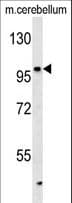 Polyclonal Rabbit anti-Human ARHGAP39 Antibody (aa852-880, WB)
