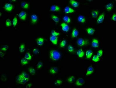 Polyclonal Rabbit anti-Human CTNNA1 / Catenin Alpha-1 Antibody (WB)