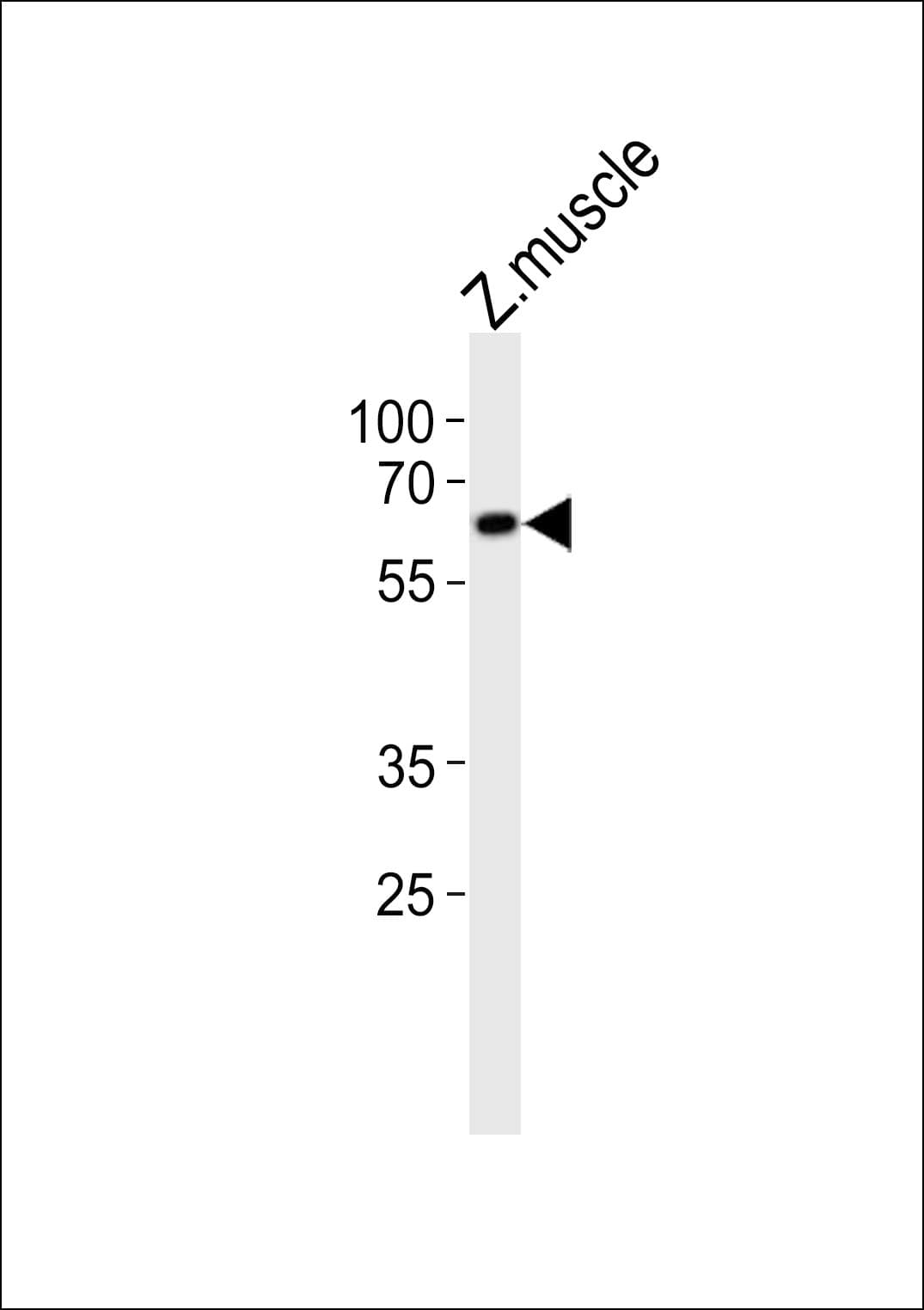 EDC3 Antibody (aa162-197)