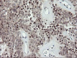 GORAB / SCYL1BP1 Antibody (aa35-394, clone OTI4F11, Carrier-free)