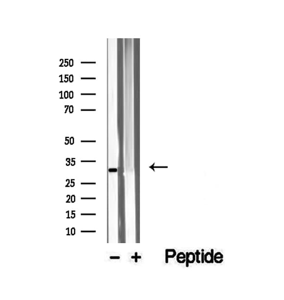 VDAC3 Antibody