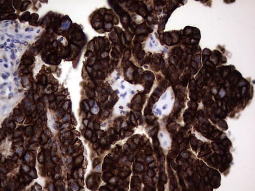 KRT19 / CK19 / Cytokeratin 19 Antibody (aa240-390, clone OTI1C11)