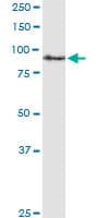 Monoclonal Mouse anti-Human APP / Beta Amyloid Precursor Antibody (clone 2C12, WB)