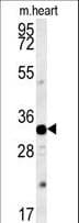 Polyclonal Rabbit anti-Human AQP11 / Aquaporin 11 Antibody (aa244-271, WB)