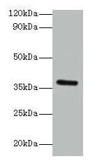 IHC-plus™ BRCC3 / BRCC36 Antibody (aa2-316)