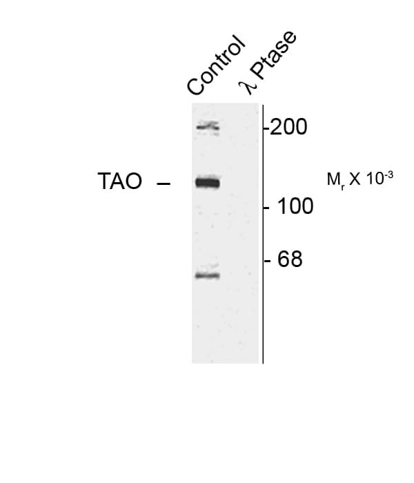 TAOK2 / TAO2 Antibody (phospho-Ser181)