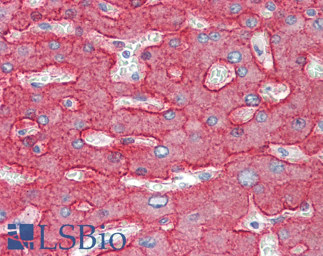 ASGR1 / ASGPR Antibody (aa100-149)