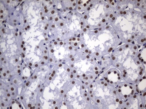 MSH2 Antibody (aa1-304, clone UMAB259)
