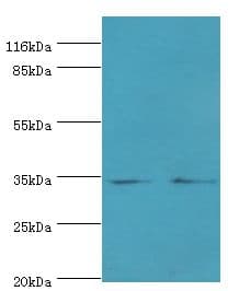 EBP Antibody (aa2-230)