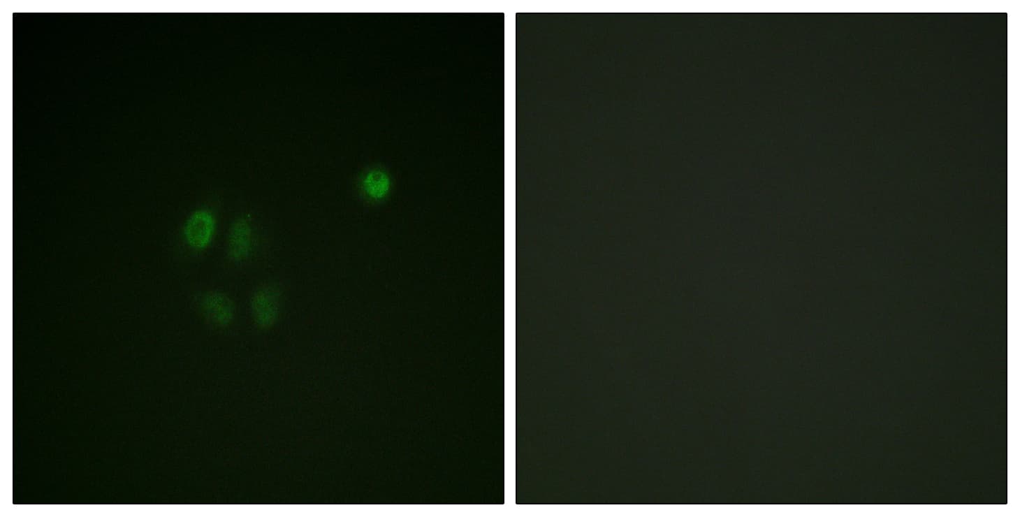 CHEK1 / CHK1 Antibody (aa271-320)