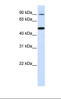 RHBDF1 Antibody (aa290-339)