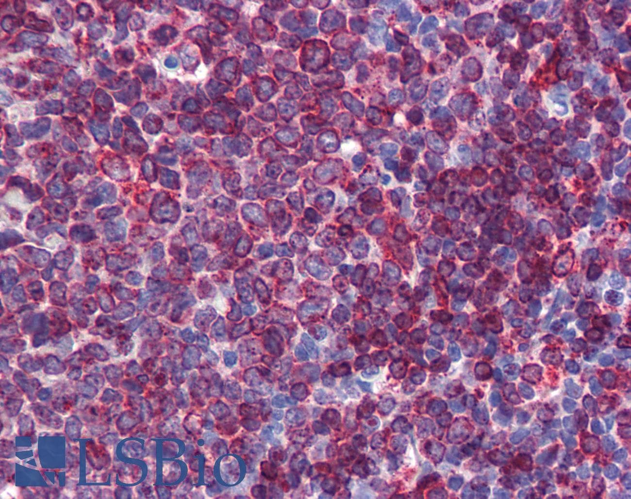 SC5D / ERG3 Antibody (aa71-120)