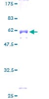 Human EXOSC1 / CSL4 Protein (Recombinant GST)