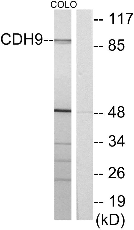 CDH9 / Cadherin 9 Antibody (aa201-250)