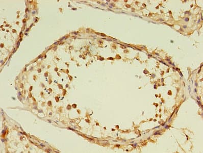 GRK4 Antibody (aa1-245)