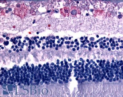 IHC-plus™ GPR75 Antibody (C-Terminus)
