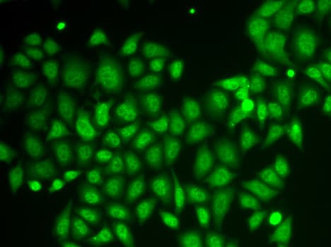 Polyclonal Rabbit anti-Human AKR1A1 Antibody (IHC, IF, WB)