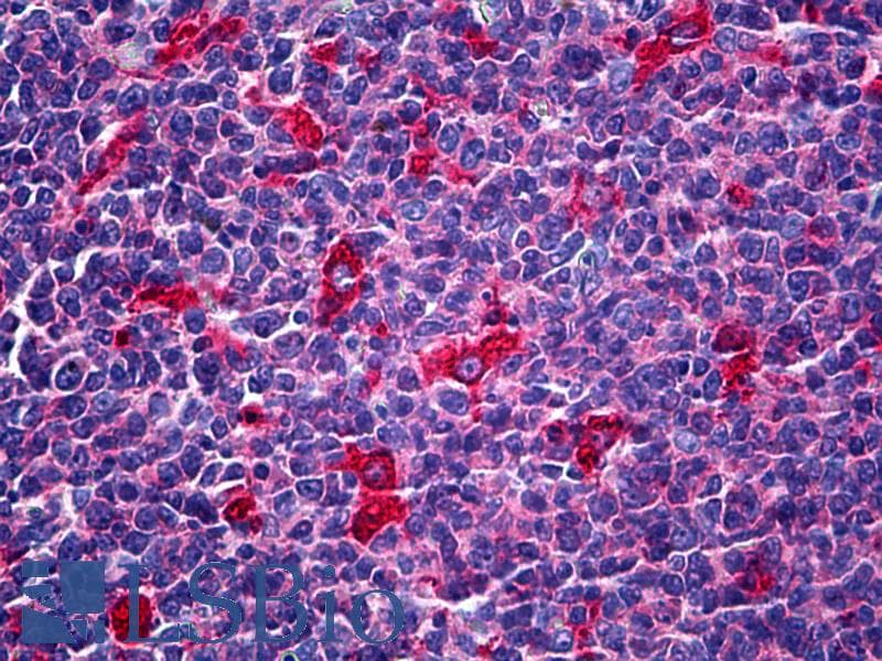 IHC-plus™ ATP6V1A1 / ATP6V1A Antibody (clone 4F5)